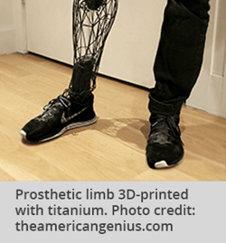 Titanium limb
